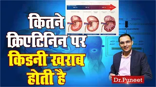 कितने क्रिएटिनिन पर किडनी खराब होती है | How much creatinine level is dangerous ? Dr Puneet