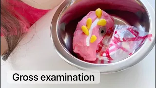 Playdough Surgery 🔪🥒 - Part 2: Pathology - Gross Examination