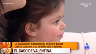 Asociación Síndrome de Williams en TVE 24/11/2015