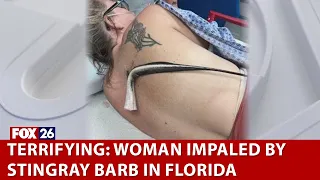 TERRIFYING: Woman impaled by stingray barb in Florida