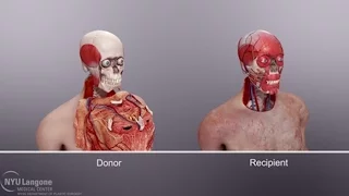 The surgeon who performed the first face transplant told us how he did it