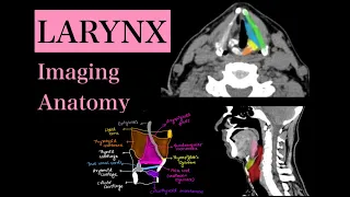 LARYNX ANATOMY - Illustrations & Imaging  of anatomical structures lRadiology- CT anatomy