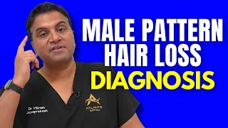 How Male Pattern Hair Loss is Being Diagnosed