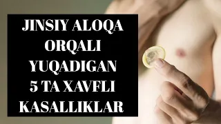 JINSIY ALOQA ORQALI YUQADIGAN 5 TA XAVFLI KASALLIKLAR