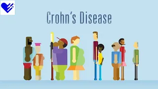 6 Food Facts for Crohn's Disease | Healthgrades