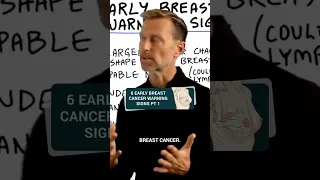 Dr. Berg explains the 6 early breast cancer warning signs pt 1 #drberg #breastcancer #cancer #health