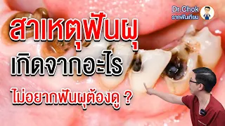 EP.1 | ฟันผุเกิดจากอะไร ทำไมบางคนฟันผุบางคนฟันไม่ผุ คลิปนี้มีคำตอบ ? | คลายปัญหารากฟันเทียมกับหมอโชค