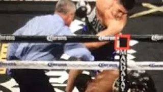 (Post Fight Recap)Dmitry Bivol 4rd tko over Cedric Agnew.