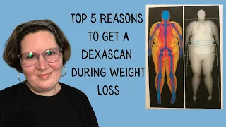Top 5 Reasons to get a Dexascan while Losing Weight | Body Composition Dexa scan Weight Loss