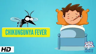 Chikungunya Fever, Causes, Signs and Symptoms,Diagnosis and Treatment.