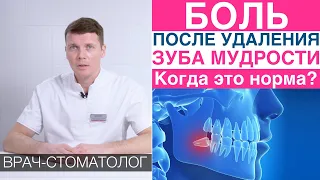 Боль после удаления зуба - когда боль это норма, как уменьшить боль после удаления зуба мудрости