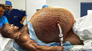 This Bodybuilder Took It WAY TOO FAR..