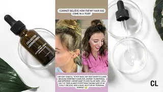 Dani Austin shares her Collective Laboratories Activating Serum results