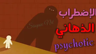 5 علامات تدل على الاضطراب الذهاني حسب DSM-5