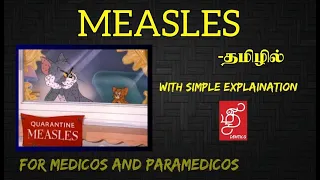 WHAT IS MEASLES ? | MMR VACCINE | MEASLES -IN TAMIL    #MEDICINE #PATHOLOGY