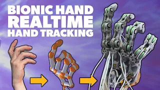 Controlling my Bionic Hand With Realtime Motion Tracking - Biomimetic Bionic Hand