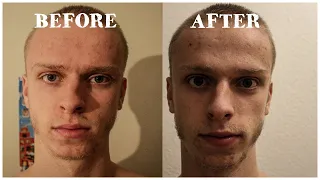 100 Hours Without Food // Water Fast // INSANE TRANSFORMATION
