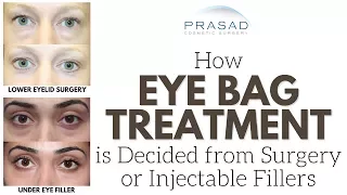 Eye Bags - How a Doctor Experienced with Surgery and Under Eye Fillers Decides on Treatment