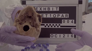 COMING: THE LARGEST DNA EVIDENCE OF ELONGATED SKULLS FROM PERU