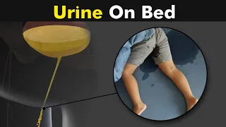 Why Childs and some adults do urine on bed? | Bedwetting - Causes and treatment (Urdu/Hindi)