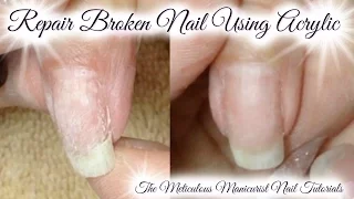 Acrylic Nail Tutorial: How To Repair or Patch Broken Natural Nail