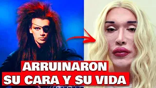 El día que MURIÓ Pete Burns - Biografía del músico ADICT0 a las cirugías