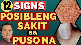 12 Signs na Posibleng Sakit sa Puso Na. - By Doc Willie Ong (Internist and Cardiologist)