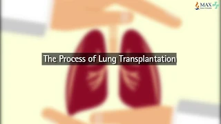 The Process of Lung Transplantation and Combined Heart-Lung Transplant