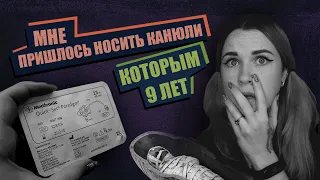 ЧТО ПРОИСХОДИТ С КАТЕТЕРАМИ ДЛЯ ПОМПЫ СПУСТЯ НЕСКОЛЬКО ЛЕТ ? | СОВРЕМЕННЫЕ ДИАБЕТ ТЕХНОЛОГИИ