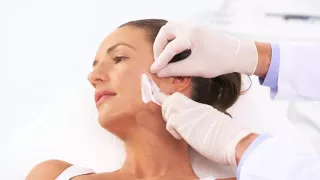 EndyMed Pro Intensif Microneedling Treatment