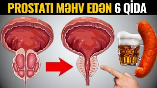 Prostatı Öldürən 6 Qida - AMAN DİQQƏT! YEMƏYİN