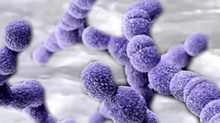 Flesh eating bacteria lands woman in hospital