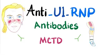 Anti-U1-Ribonucleoprotein (Anti-U1-RNP) autoantibodies
