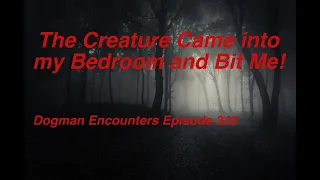 Dogman Encounters Episode 345 (The Creature Came into my Bedroom and Bit Me!)