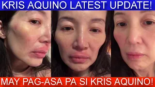 KRIS AQUINO LATEST UPDATE | ANG PAGBABAGO NI KRIS IK!NAGULAT NG LAHAT!