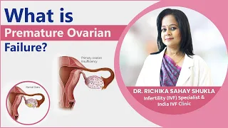 What is Premature Ovarian Failure? Its Treatment & Symptoms #DrRichikaSahayShukla