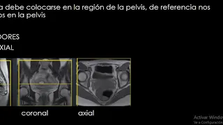 Protocolo de resonancia magnética pelvis femenina