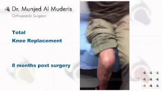 Total Knee Replacement - 8 months post surgery