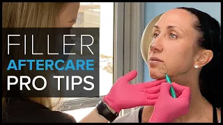 What Happens After a Filler Treatment? Bruises, Swelling, and Aftercare Tips