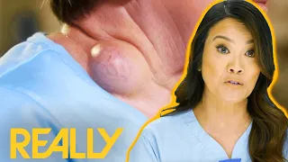 Dr. Lee Removes Big Cyst On Patients Neck l Dr. Pimple Popper