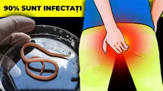 Cum să Scapi de VIERMII Paraziți?! 90% din Oameni Sunt INFECTAȚI! Remedii Naturale Care CHIAR AJUTĂ