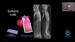 Radio-diagnosis of spine degenerative disorders I Dr. Mamdouh Mahfouz