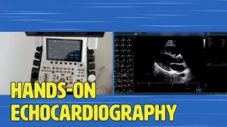 〖Echocardiography〗 Cardiac views & measurements hands-on (full version) 💫 💟