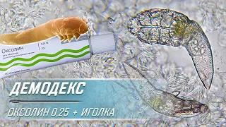 Угревая Железница Demodex | Как мазь Оксолин убивает клеща