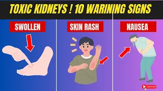 10 Weird Warning Signs That Your Kidneys are Toxic | Chronic Kidney Disease | Kidney Health | CKD