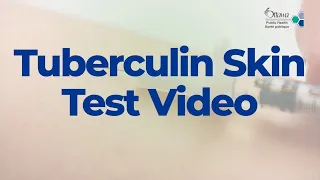 Tuberculin Skin Test Video - 2022