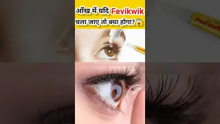 आँख में यदि Fevikwik चला जाए तो क्या होगा?😱 #trending #reels #facts #hindi #india