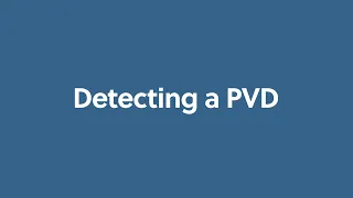 Detecting a PVD