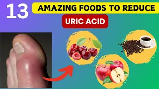 Say Goodbye to Gout: 13 Foods That Reduce Uric Acid!