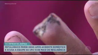 Metalúrgico perde dedo após acidente doméstico